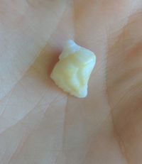 gbif image for Coralliophila caribaea