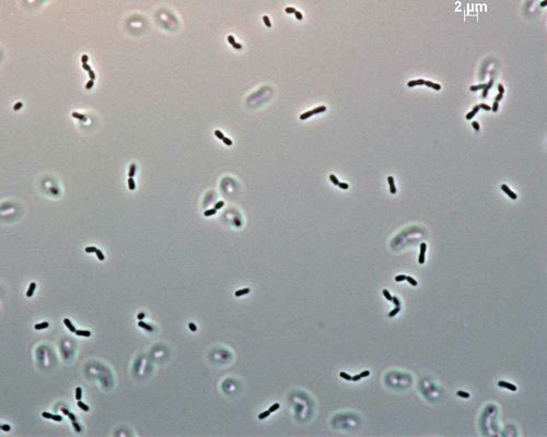 <em>Dyadobacter soli</em> Lee et al., 2010, collected in Republic of Korea. Via <a href="/occurrence/1831403086">Leibniz Institute DSMZ - German Collection of Microorganisms and Cell Cultures GmbH</a>, licensed under <a href="http://creativecommons.org/licenses/by-nc/4.0/">CC BY-NC 4.0</a>.